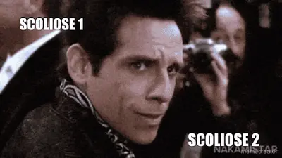 SCOLIOSE 1 - SCOLIOSE 2 meme
