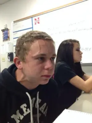 bulging vein meme template